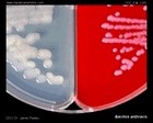 bacillus anthracis appearance